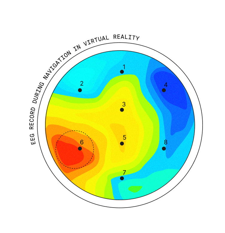 EEG Traditional Layout